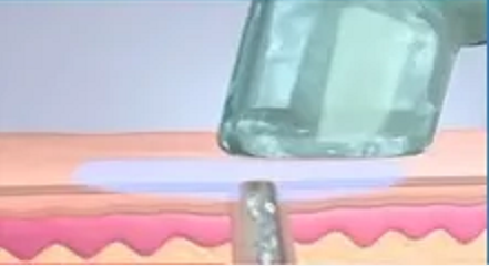 HydraClear EP — detail 4