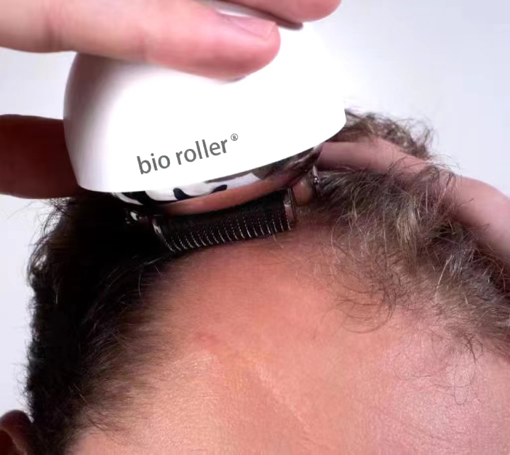 The Bioroller For Hair Growth — detail 3